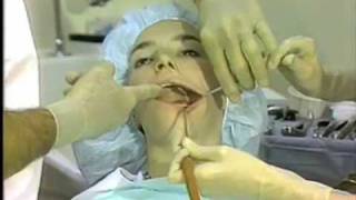 General Procedures in Oral Surgery [upl. by Boaten]