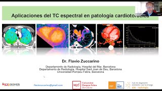 539  Aplicaciones del TC espectral en radiología Cardiotoracica [upl. by Lacombe473]