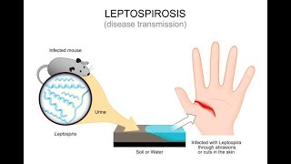 Understanding Leptospirosis Symptoms and Treatment  Expert Guide [upl. by Margery]