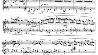 Beethoven Sonata quotPathetiquequot Op 13  III Rondo Allegro [upl. by Anwahsar]