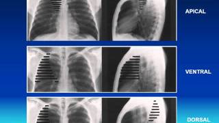 RADIOLOGIE ANATOMIE LOBAIRE ET SEGMENTAIRE [upl. by Andrel]