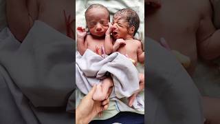 Adorable Twin Newborn Babies Vs Cutest Single Newborn Baby [upl. by Thay]