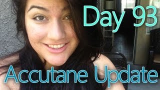 Day 93 Accutane SEVERE Acne Update NO MORE ACNE [upl. by Adyht]