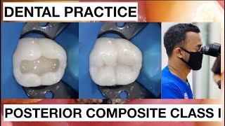 Dental Practice Class I Composite Restoration  General Dentist Griya RR [upl. by Traggat]