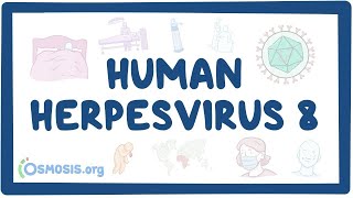 Human herpesvirus 8 Kaposis sarcoma  an Osmosis Preview [upl. by Suravaj304]