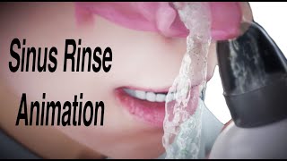 Sinus Rinse Animation [upl. by Linetta987]