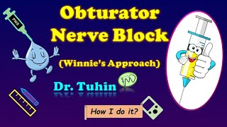 Obturator Nerve Block  PNS Guided Obturator Nerve Block  Landmark  Winnies Classic Technique [upl. by Cornia]