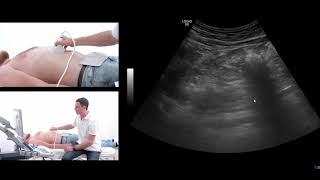 How to perform an ultrasound exam of the pancreas [upl. by Frederigo]