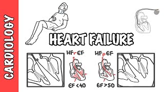 Heart failure with reduced and preserved ejection fraction pathophysiology and treatment [upl. by Duer]