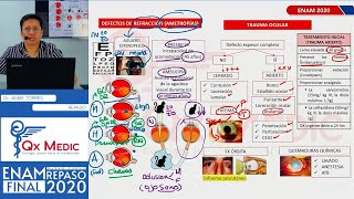 REPASO TEÓRICO  OFTALMOLOGÍA [upl. by Labotsirc]