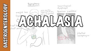 Achalasia esophageal  signs and symptoms pathophysiology investigations and treatment [upl. by Darees948]