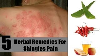 5 Home Remedies for Shingles Nerve Pain  By Top 5 [upl. by Ellimak]