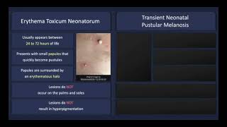 Transient neonatal pustulosis vs erythema toxicum neonatorum Dermatosis of infancy dermatology [upl. by Annaerdna]