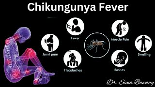 Chikungunya Fever Signs and SymptomsDiagnosis and Treatment [upl. by Aicilaf]