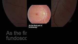 Examining the fundus – part 3 ophthalmology [upl. by Aisul]