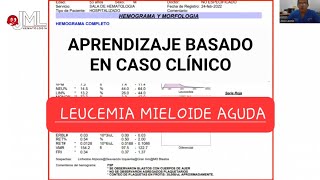 LEUCEMIA MIELOIDE AGUDA APRENDIZAJE BASADO EN CASO CLÍNICOleucemia medicina [upl. by Orlene]