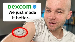 Dexcom G7 Major Upgrades Revealed – Don’t Miss Out [upl. by Danaher941]