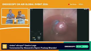 1  Ambu® aScope™ Gastro Largemp4 [upl. by Delorenzo]