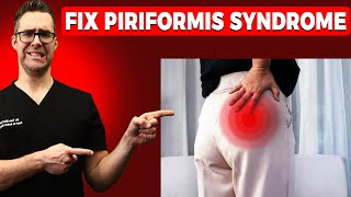 Piriformis Syndrome Wont Go Away Stretches I Exercises I Treatment [upl. by Assetak]