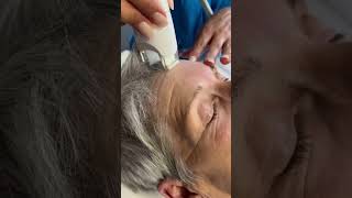 Antiaging face treatment AntiAging Lahore Faceprp acnesolution acnetreatment facetreatment [upl. by Etnovad]