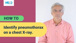 How to identify pneumothorax on a chest Xray [upl. by Rramed822]