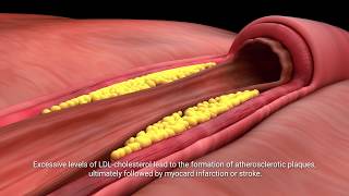 Lactobacillus plantarum INDUCIA [upl. by Nate]