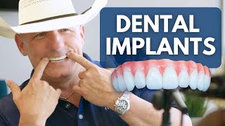 Why No One Tells You The Cost Of Dental Implants [upl. by Sivlek621]