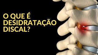 O que é Desidratação Discal [upl. by Jennine]