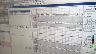 Charting Probing in a Returning Patient in Open Dental [upl. by Bust]