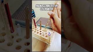 Haemoglobin test medical colorimetria lab [upl. by Nauqes]