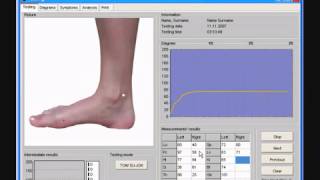 Meridian Testing Program 20 Ryodoraku diagnostic method of 24 points with Software [upl. by Powers150]