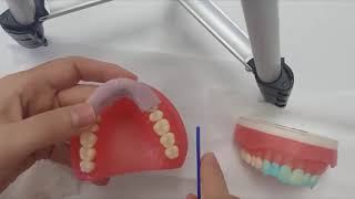 How To Use Zhermack Zhermack Acrytemp Temporary Crown Bridge Material Dentbearcom [upl. by Ymarej312]