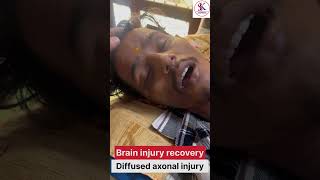 Diffused axonal injury strokepatient strokepatient education strokesurvivor nervoussystem [upl. by Bessy32]