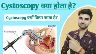 Cystoscopy in Hindi  Cystoscopy meaning  Purpose and Complications of Cystoscopy [upl. by Moazami]