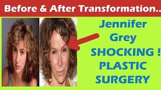 Jennifer Grey Plastic Surgery Before and After Full HD [upl. by Alekahs]