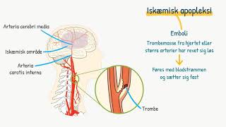 Nervesystemet Apopleksi [upl. by Torrlow]