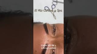 Lifting de Pestañas y Depilación de Brazos con láser laserdiodo cejashd4k pielhermosa [upl. by Bitthia]