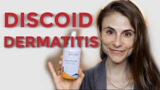 DISCOID NUMMULAR DERMATITIS TIPS FROM A DERMATOLOGIST DR DRAY [upl. by Necila]