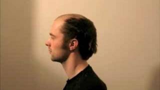 Timelapse of Haircut  Jørgen looses all his hair [upl. by Aylward]