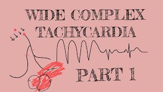 Wide complex tachycardia  Part 1 [upl. by Nosilla]