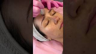 ✨ HydroDiamond Facial  RF Skin Tightening ✨ [upl. by Schott]