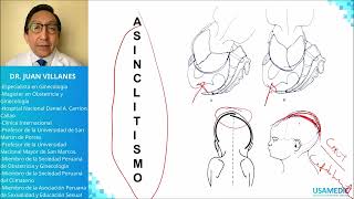 Distocias  Maniobras USAMEDIC  Obstericia 5 [upl. by Didi]