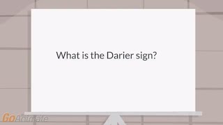 What is the Darier sign [upl. by Archambault]