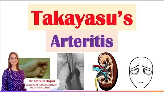 Takayasu Arteritis  Dr Shruti Bajad skincare arthritis autoimmunecare skin arthritispain [upl. by Assili425]