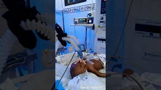 This Newborn baby on a ventilator newborn newbornbaby nicuventilator [upl. by Valtin]