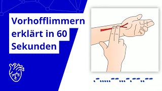 Was ist eigentlich Vorhofflimmern In einer Minute erklärt [upl. by Grete]