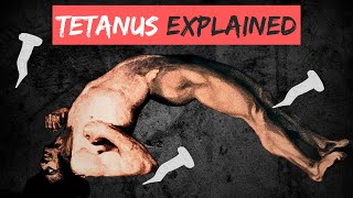 TETANUS explained in 10 Minutes [upl. by Yadsendew]