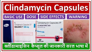 Clindamycin Capsules क्लींडामाइसिन कैप्सूल की जानकारी सरल भाषामें Dose Use Side effect Warning [upl. by Eamon]