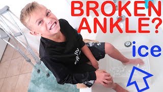 BROKEN ANKLE Super Cold Ice Bath [upl. by Nosreh]