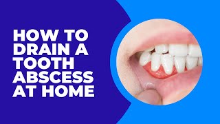 Should you Drain a Tooth Abscess at Home [upl. by Asle]